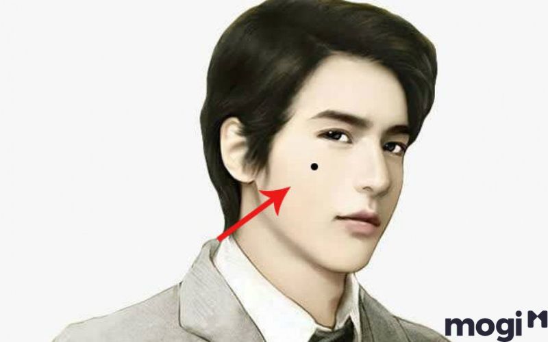 Nốt ruồi trên mặt đàn ông ở gò má