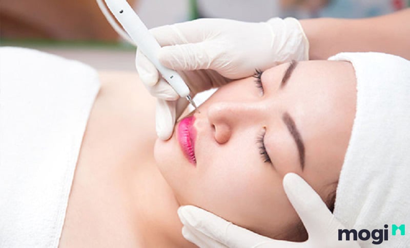 Nốt ruồi trên mặt phụ nữ