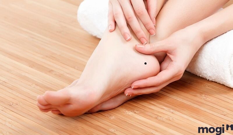 Nốt ruồi ở chân tốt hay xấu