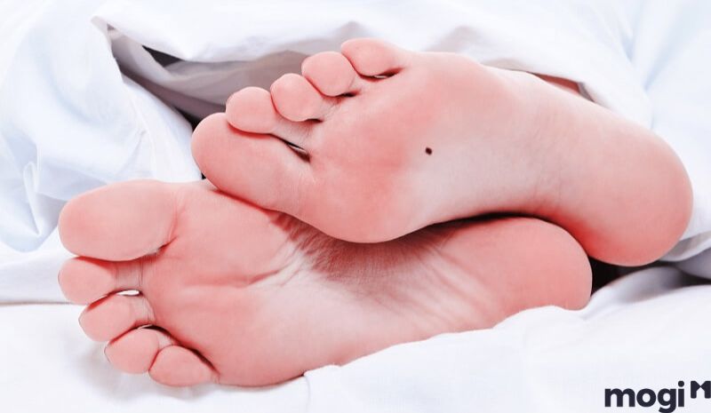 Nốt ruồi ngay trong lòng bàn chân 