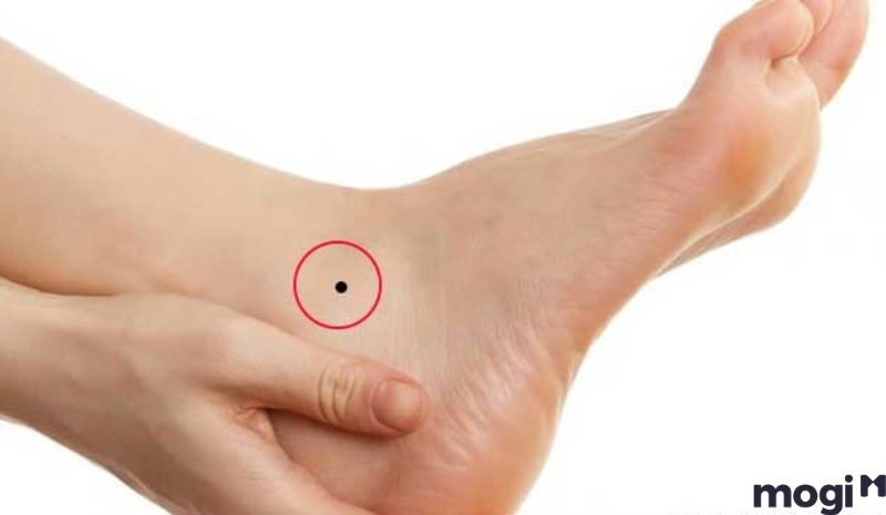 Xóa nốt ruồi ở chân có nên không?