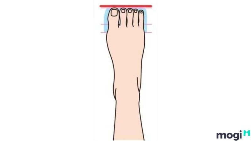 Tướng bàn chân có độ dài các ngón gần như bằng nhau
