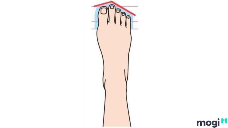 Tướng bàn chân có độ dài ngón thứ 2 dài nhất