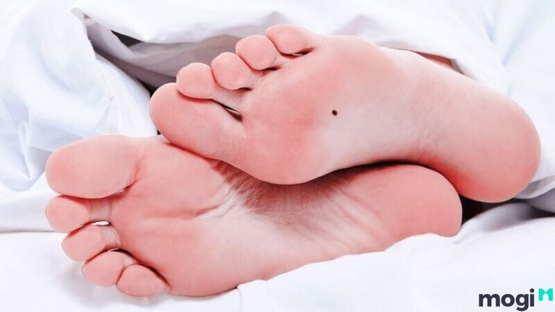 Nốt ruồi ở lòng bàn chân được xem là tướng bàn chân sướng