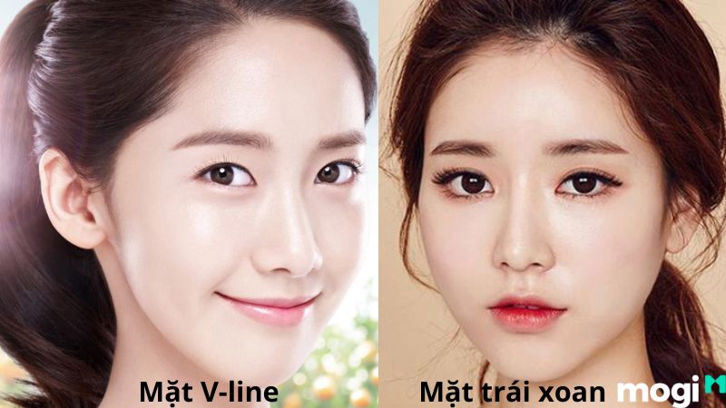 Phân biệt mặt trái xoan và mặt V-line