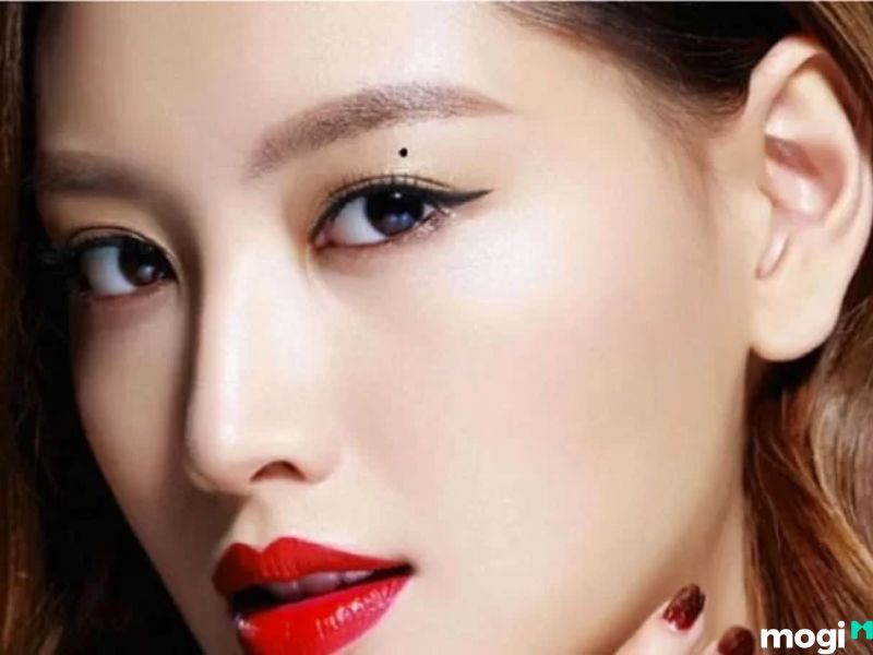 nốt ruồi mí mắt