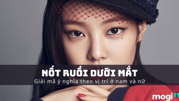 nốt ruồi dưới mắt