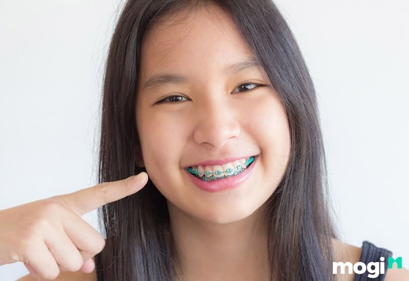 Mặt Chữ Điền Là Gì? Giải Đáp Tướng Số, Vận Mệnh Người Mặt Chữ Điền 19 Phương pháp niềng răng an toàn hơn
