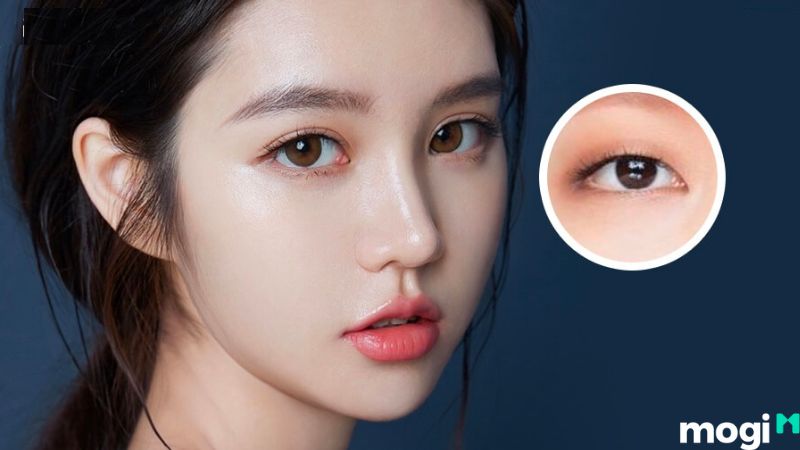 Mắt mí lót là gì?