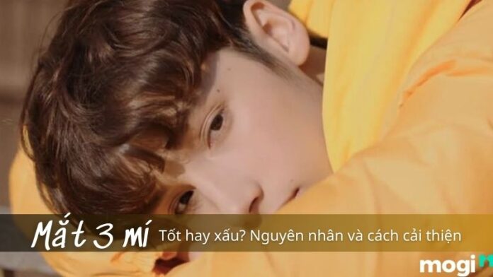 mắt 3 mí