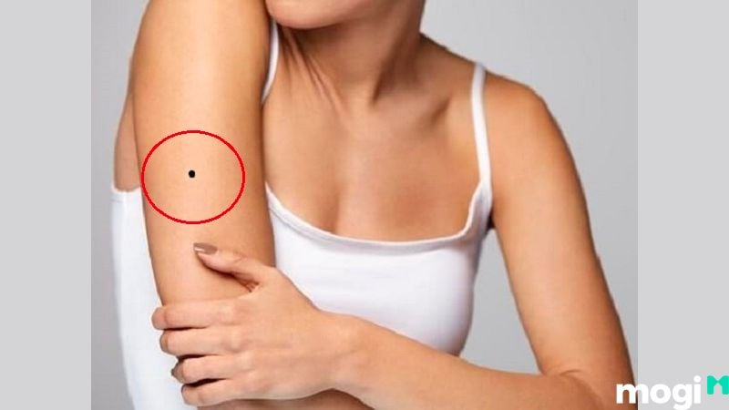 Nốt ruồi ở cánh tay phải 