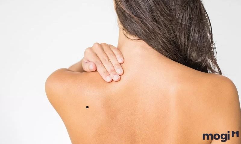 Giải Mã Ý Nghĩa Mb665 đăng ký tài khoản Ở Vai Nam Nữ Chi Tiết Từng Vị Trí 11 Nốt ruồi ở xương bả vai có ý nghĩa gì?