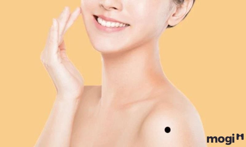 Giải Mã Ý Nghĩa Mb665 đăng ký tài khoản Ở Vai Nam Nữ Chi Tiết Từng Vị Trí 9 Nốt ruồi ở đầu bả vai