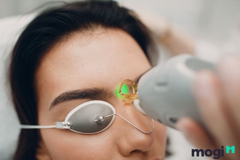 Bạn có thể đi triệt lông mày để có hiệu quả cao nhất