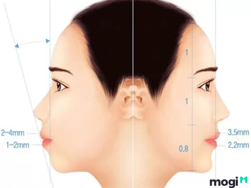 <strong>Cằm Lẹm Là Gì? Bật Mí Bí Ẩn Về Tướng Số Và Cách Cải Thiện</strong> 1 Đặc điểm và biểu hiện của cằm lẹm