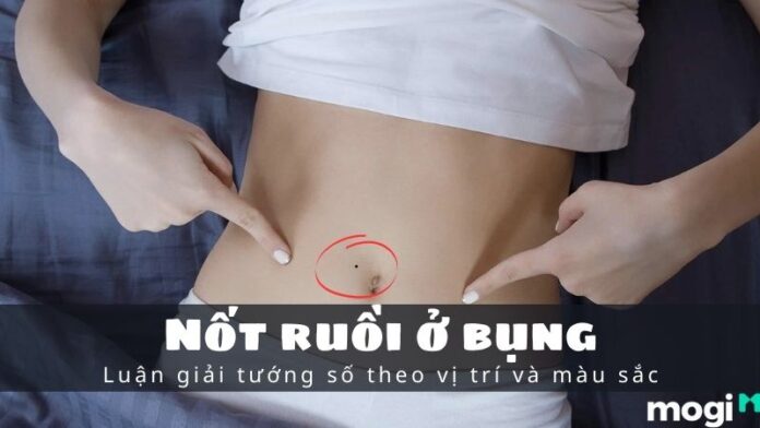 Nốt ruồi ở bụng