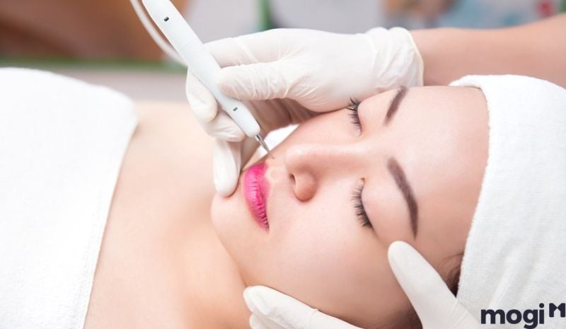 Lưu ý trước khi tẩy nốt ruồi ở cánh mũi