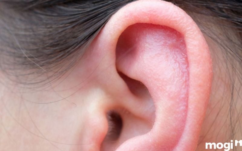 Tai bị khô cũng là tác nhân gây ngứa