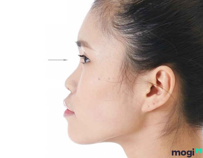 Sơn căn thấp, lõm cuộc đời nhiều khó khăn.