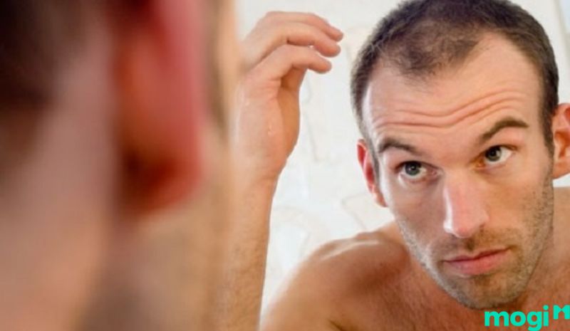 Khái niệm về trán chữ M