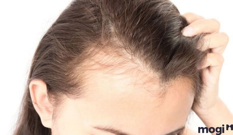 Vận số, tử vi của nữ sở hữu trán chữ M