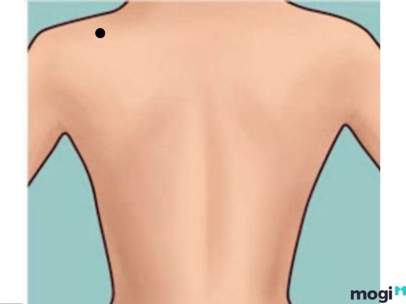 Nốt ruồi ở lưng