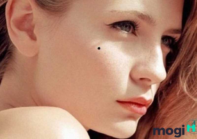 Nốt ruồi trên gò má phải