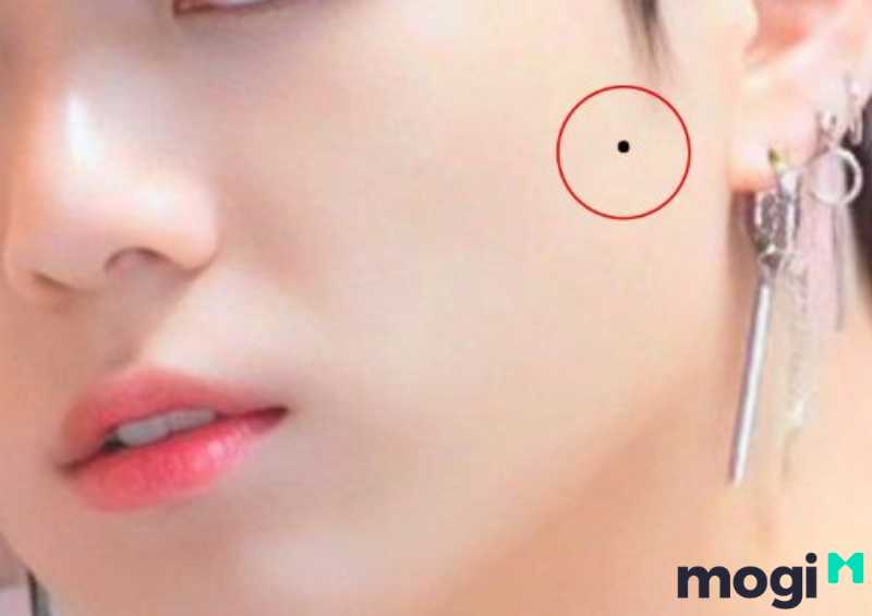 Nốt ruồi trên má gần tai