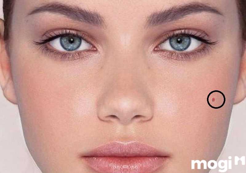 Nam và nữ sở hữu nốt ruồi son trên má