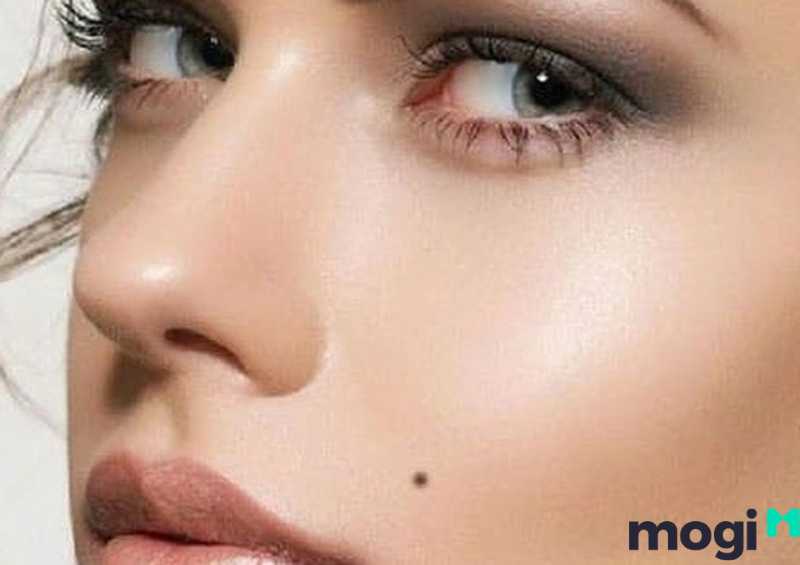 Có nên xóa nốt ruồi trên má hay không?