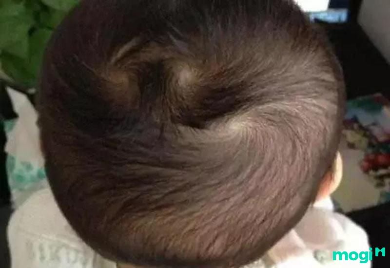 <strong>Xoáy Tóc Là Gì? Các Kiểu Xoáy Tóc Phổ Biến Và Ý Nghĩa Vận Mệnh Các Kiểu Xoáy Tóc</strong> 4 xoáy tóc