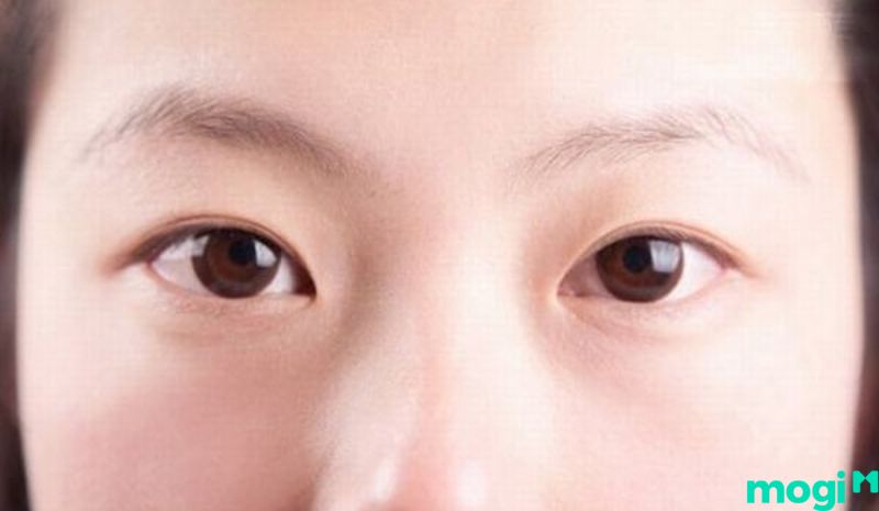 Mắt 1 mí là gì - Khái niệm về tướng mắt này