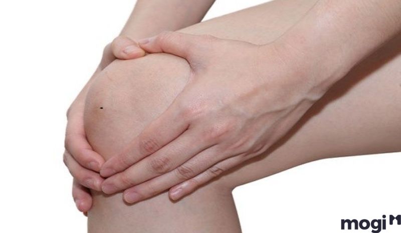 Nốt ruồi đem lại vận may thì bạn nên giữ lại 