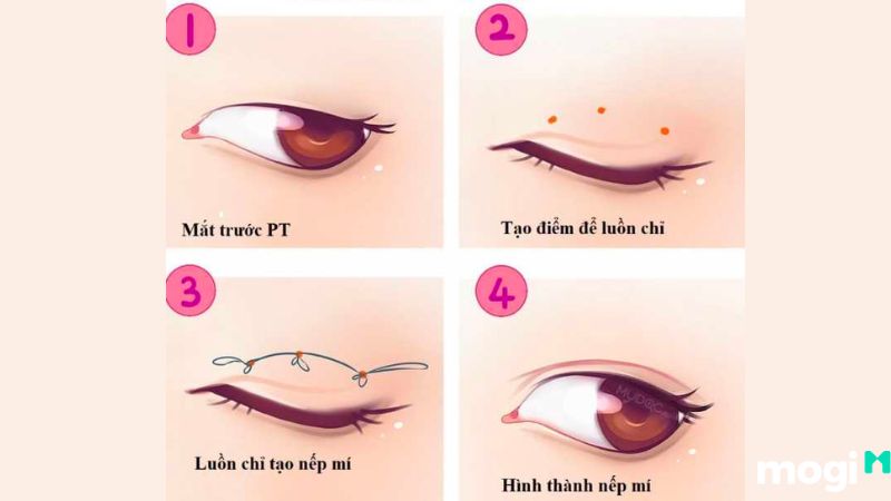 Mắt Hạnh Nhân Là Gì? Giải Mã Vận Mệnh Chuẩn Xác Nhất Theo Nhân Tướng Học 10 Mắt hạnh nhân