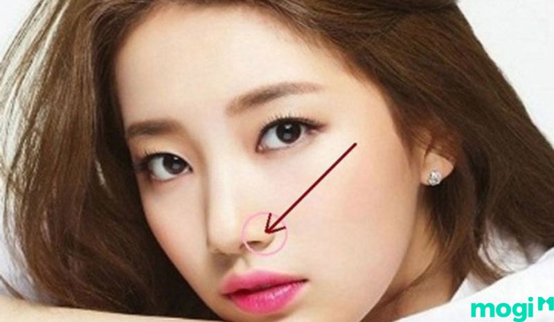 Bạn có thể cân nhắc việc sửa mũi bằng một số câu hỏi