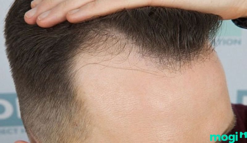 Chiếc trán là biểu tượng cho sao Tam Thai