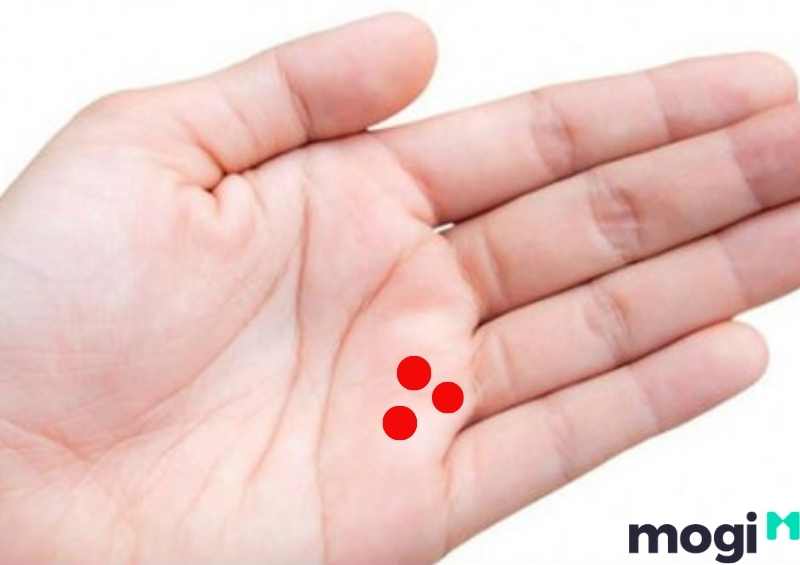 Gò Thái dương có nhiều chấm