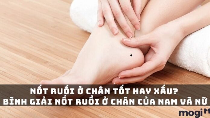 nốt ruồi ở chân