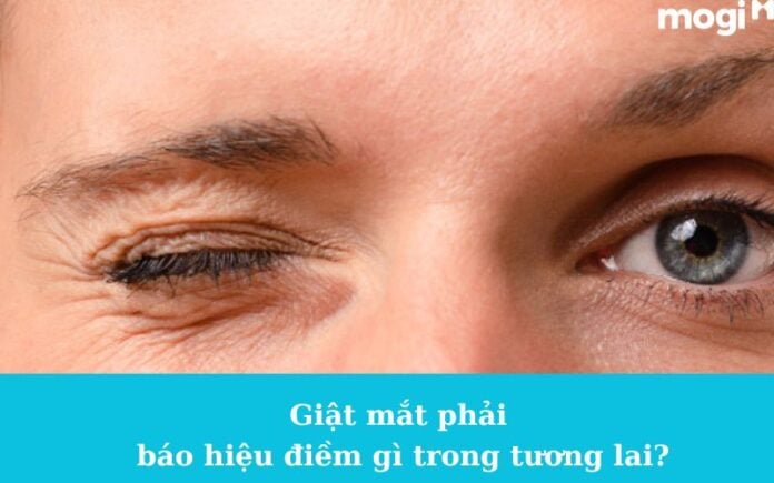 Giật mắt phải