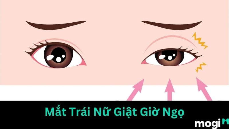 giật mắt trái nữ giờ Ngọ