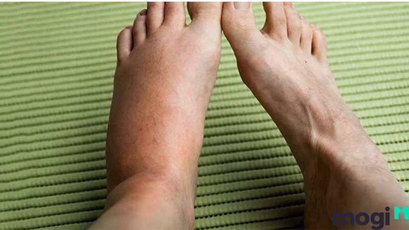 Bị ong đốt là điềm gì?