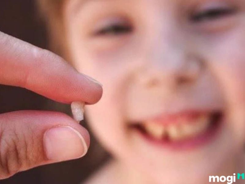 Nằm mơ thấy rụng răng không chảy máu