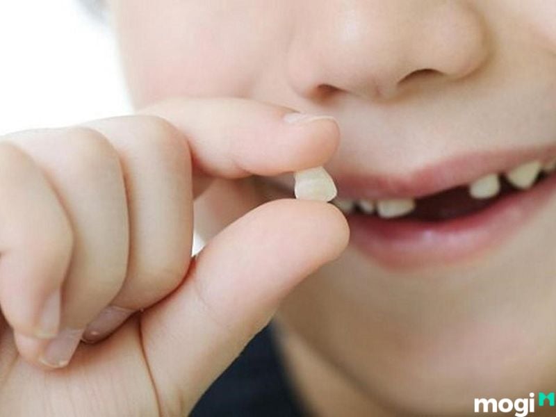 Nằm mơ thấy rụng răng do triệu chứng trầm cảm