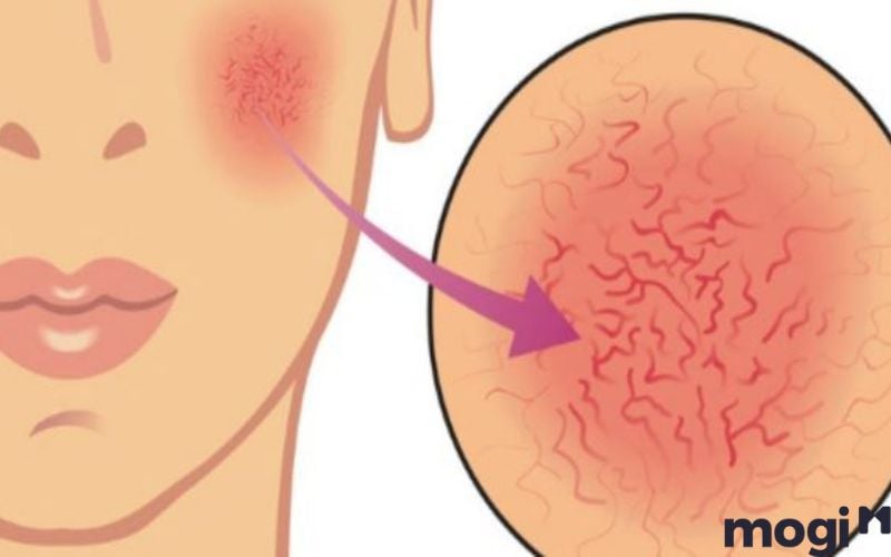 Ngủ mơ thấy máu trên mặt