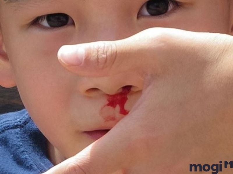 Mơ thấy người khác chảy máu