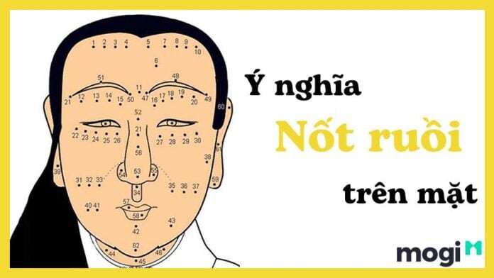 nốt ruồi trên mặt