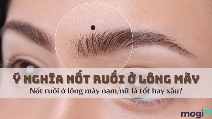 nốt ruồi ở lông mày