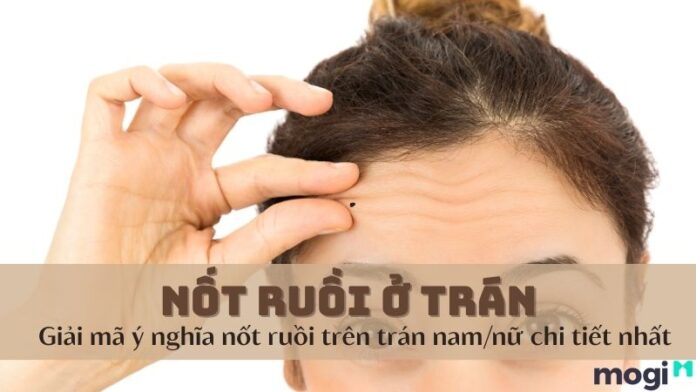 Nốt ruồi ở trán
