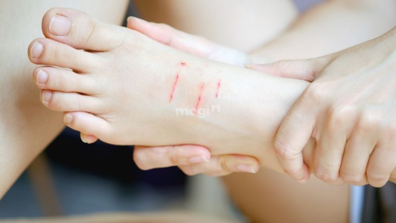 Mơ thấy mèo là điềm lành hay dữ? Giải mã con số liên quan 6 Nếu mơ thấy bị mèo cào, hãy cẩn thận vì đó là điềm báo có ai đó đang đố kị