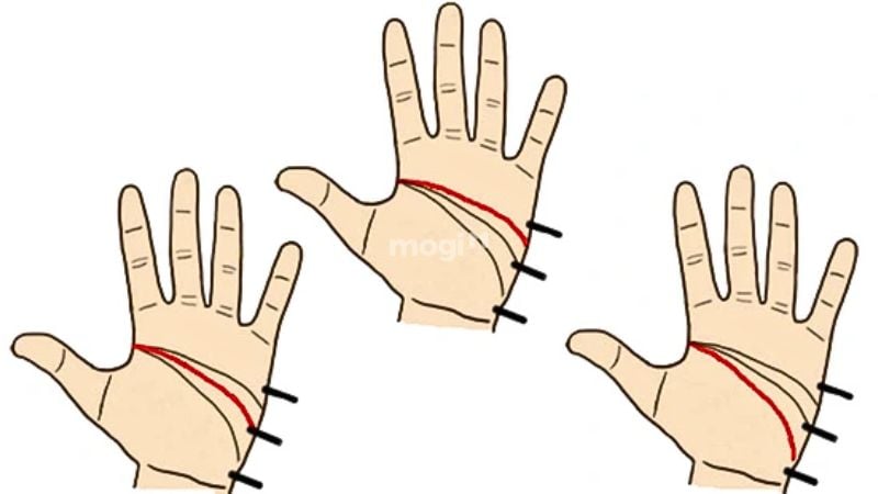 Vị trí đường trí đạo trên lòng bàn tay